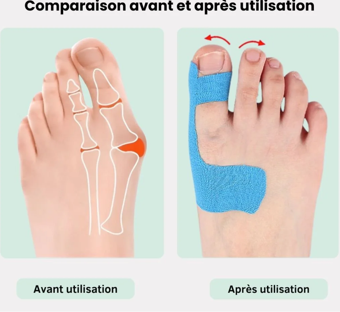10 Tape pour Hallux Valgus | Soulagement & Correction