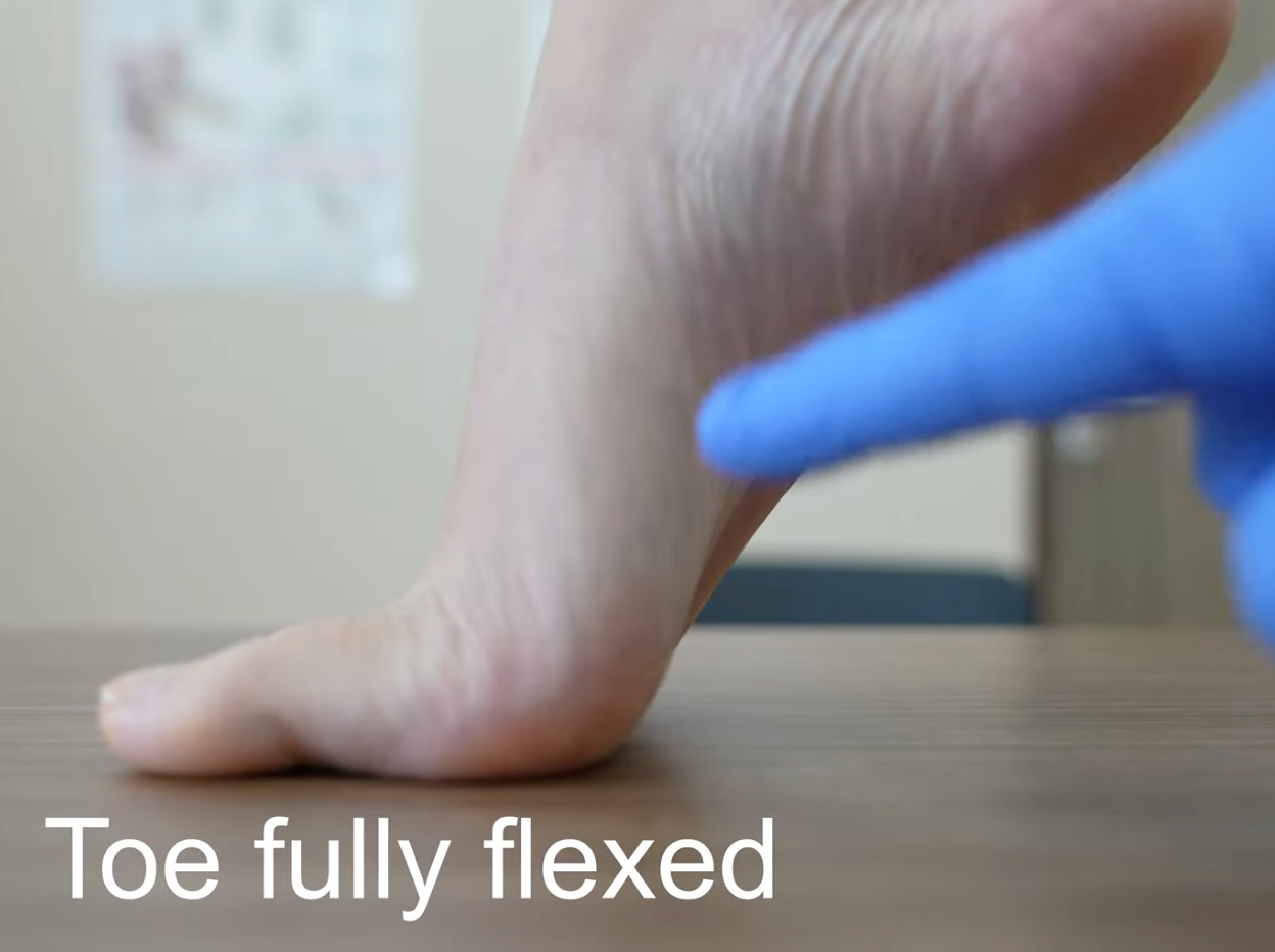 10 Tape pour Hallux Valgus | Soulagement & Correction